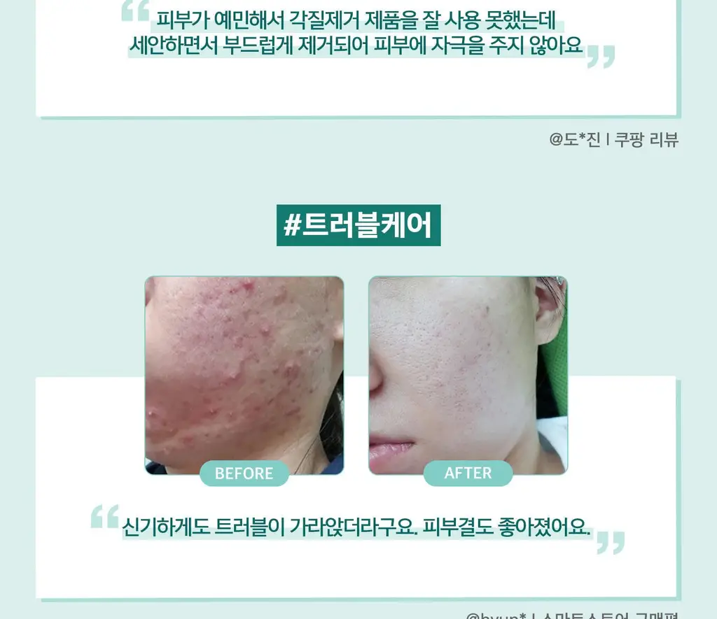 [민감성/여드름성피부적합] 테라비코스 엔자임 워싱 파우더 40g 상세페이지 39